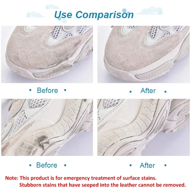 2026 Borrador Limpiador para Z - Sneaker Care Whitener reseña y precio